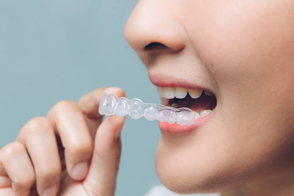 The best orthodontist in Ripley WV explains why no matter how old or young you are, you can still fix your smile with Invisalign