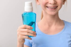 mouthwash and braces, should you use them together?