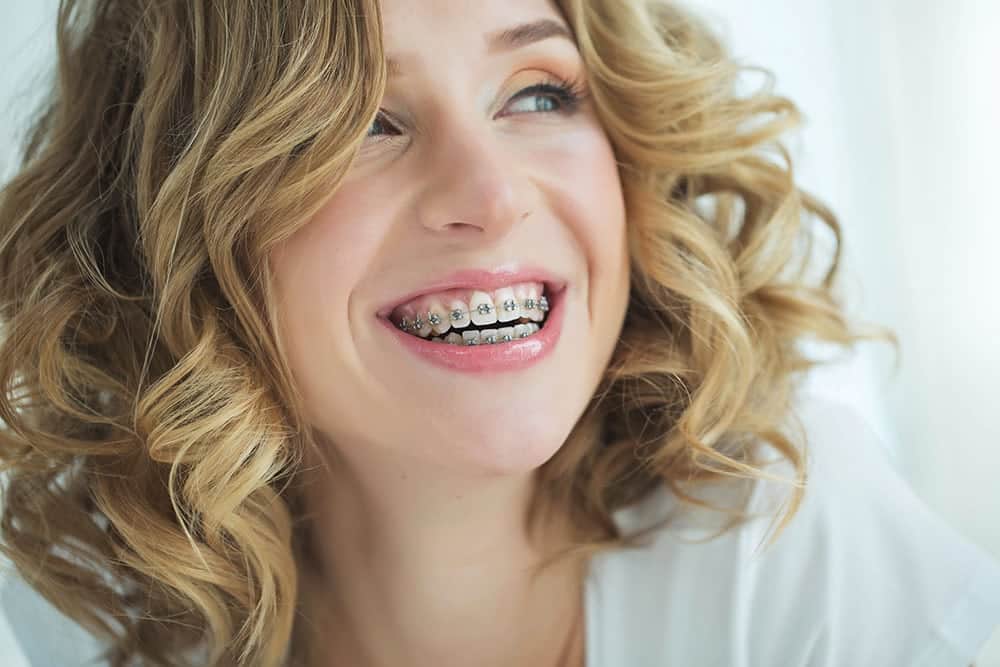 Here are some of the most common questions about braces for adults.