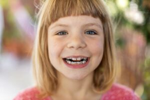 making braces fun for kids Smith Orthodontics in Parkersburg and Ripley, WV