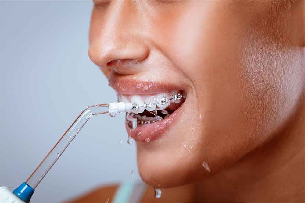 air flossing and water flossing Smith Orthodontics in Parkersburg and Ripley, WV