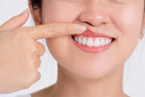 Do Braces Cause Gum Recession? Smith Orthodontics in Parkersburg and Ripley, WV