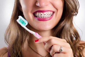 best toothpaste for braces Smith Orthodontics in Parkersburg and Ripley, WV.